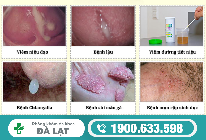 Hình ảnh minh họa